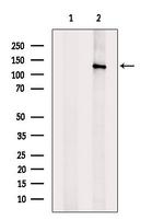 TBC1D1 Antibody in Western Blot (WB)