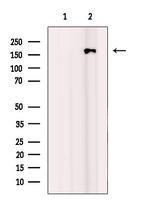 BCL9L Antibody in Western Blot (WB)