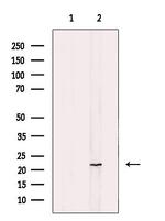 NT5C Antibody in Western Blot (WB)