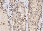 BAP1 Antibody in Immunohistochemistry (Paraffin) (IHC (P))