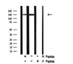 Phospho-TYK2 (Tyr1054) Antibody in Western Blot (WB)