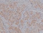 Phospho-BACE1 (Ser498) Antibody in Immunohistochemistry (Paraffin) (IHC (P))