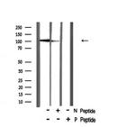 Phospho-CtIP (Ser327) Antibody in Western Blot (WB)