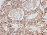 Phospho-DNA-PK (Thr2609) Antibody in Immunohistochemistry (Paraffin) (IHC (P))