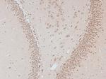 Phospho-DNA-PK (Thr2609) Antibody in Immunohistochemistry (Paraffin) (IHC (P))