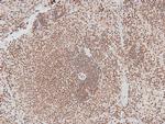 Phospho-IRAK1 (Thr387) Antibody in Immunohistochemistry (Paraffin) (IHC (P))