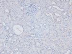 Phospho-NFkB p105 (Ser923) Antibody in Immunohistochemistry (Paraffin) (IHC (P))