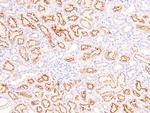 Phospho-RHOA (Ser188) Antibody in Immunohistochemistry (Paraffin) (IHC (P))