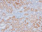 Phospho-RHOA (Ser188) Antibody in Immunohistochemistry (Paraffin) (IHC (P))