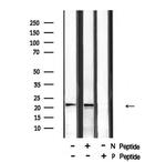 Phospho-RHOA (Ser188) Antibody in Western Blot (WB)