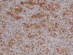 Phospho-VAV1 (Tyr160) Antibody in Immunohistochemistry (Paraffin) (IHC (P))