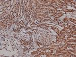 Phospho-VEGF Receptor 2 (Tyr996) Antibody in Immunohistochemistry (Paraffin) (IHC (P))