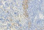 Phospho-HSL (Ser660) Antibody in Immunohistochemistry (Paraffin) (IHC (P))