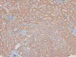 Phospho-HSL (Ser660) Antibody in Immunohistochemistry (Paraffin) (IHC (P))