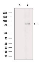 Phospho-PKC beta (Ser661) Antibody in Western Blot (WB)