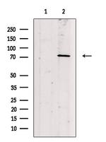 Phospho-PKC beta (Ser661) Antibody in Western Blot (WB)