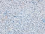 Phospho-PKC beta (Ser661) Antibody in Immunohistochemistry (Paraffin) (IHC (P))