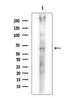 Phospho-Chk2 (Thr26, Ser28) Antibody in Western Blot (WB)