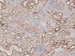 Phospho-Chk2 (Thr26, Ser28) Antibody in Immunohistochemistry (Paraffin) (IHC (P))