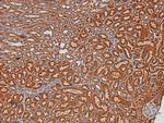 Phospho-Chk2 (Thr26, Ser28) Antibody in Immunohistochemistry (Paraffin) (IHC (P))