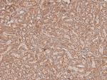 Phospho-Chk2 (Thr26, Ser28) Antibody in Immunohistochemistry (Paraffin) (IHC (P))