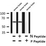 Phospho-Chk2 (Thr26, Ser28) Antibody in Western Blot (WB)