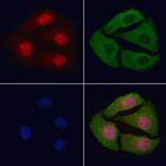 Phospho-MAP2K1/MAP2K2 (Ser218, Ser222, Ser226) Antibody in Immunocytochemistry (ICC/IF)