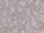 Phospho-CEACAM1 (Ser508) Antibody in Immunohistochemistry (Paraffin) (IHC (P))