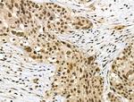 Phospho-SMAD2 (Ser255) Antibody in Immunohistochemistry (Paraffin) (IHC (P))