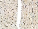 Phospho-SMAD2 (Ser255) Antibody in Immunohistochemistry (Paraffin) (IHC (P))