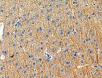 Phospho-KV4.2 (KCND2) (Ser616) Antibody in Immunohistochemistry (Paraffin) (IHC (P))