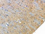 Phospho-KV4.2 (KCND2) (Ser616) Antibody in Immunohistochemistry (Paraffin) (IHC (P))