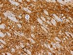 Phospho-MAP4 (Ser696) Antibody in Immunohistochemistry (Paraffin) (IHC (P))