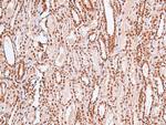 Phospho-MARK Pan (Thr215) Antibody in Immunohistochemistry (Paraffin) (IHC (P))