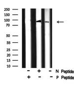 Phospho-MARK Pan (Thr215) Antibody in Western Blot (WB)