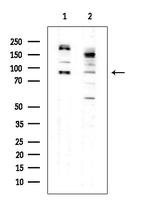 Phospho-TGFBR3 (Thr843) Antibody in Western Blot (WB)