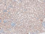 Phospho-Catenin alpha-1 (Ser641) Antibody in Immunohistochemistry (Paraffin) (IHC (P))