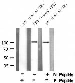 Phospho-Catenin alpha-1 (Ser641) Antibody in Western Blot (WB)