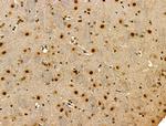 Phospho-p300 (Ser1834) Antibody in Immunohistochemistry (Paraffin) (IHC (P))