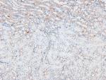 Phospho-L-Plastin (Ser5) Antibody in Immunohistochemistry (Paraffin) (IHC (P))