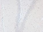 Phospho-L-Plastin (Ser5) Antibody in Immunohistochemistry (Paraffin) (IHC (P))