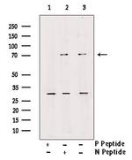 Phospho-L-Plastin (Ser5) Antibody in Western Blot (WB)