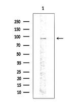 Phospho-PKD2 (Ser812) Antibody in Western Blot (WB)