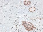 Phospho-CtIP (Ser664) Antibody in Immunohistochemistry (Paraffin) (IHC (P))