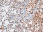 Phospho-CtIP (Ser664) Antibody in Immunohistochemistry (Paraffin) (IHC (P))