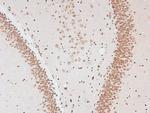 Phospho-CtIP (Ser664) Antibody in Immunohistochemistry (Paraffin) (IHC (P))