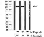 Phospho-CtIP (Ser664) Antibody in Western Blot (WB)