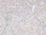 Phospho-ATM (Ser1893) Antibody in Immunohistochemistry (Paraffin) (IHC (P))