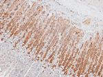 Phospho-ATM (Ser1893) Antibody in Immunohistochemistry (Paraffin) (IHC (P))