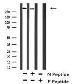 Phospho-ATM (Ser1893) Antibody in Western Blot (WB)